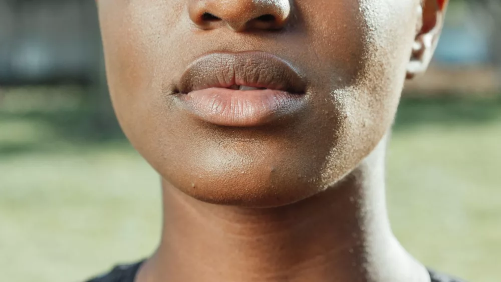 Understanding and Caring for Dusky Skin: A Comprehensive Guide